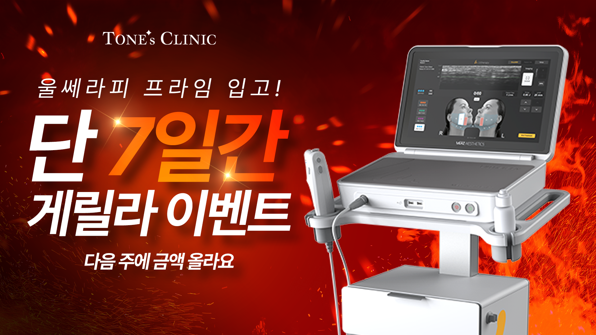 팝업
